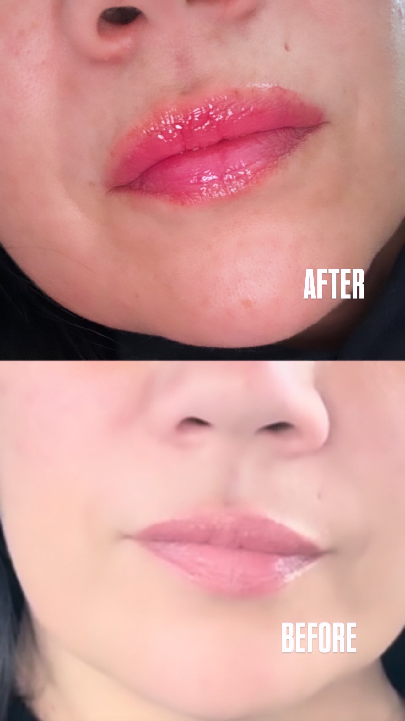LIP PLUMPER