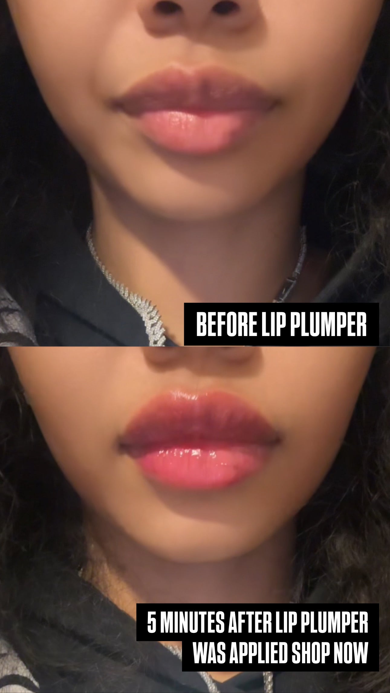 LIP PLUMPER